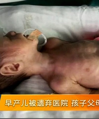 2أ丸ĸΪ17δˣԺʧ