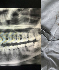 4ڰ2ǳݣϴλ1СʱΰСʱ͸㶨