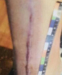 重庆女生不堪同学侮辱殴打跳楼摔残