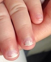 ڲָ׻ỻָף޶2ָ׾ɵĻûͳµ