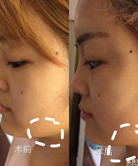 28ҷԡƻ壬顰沿Ů񡱸˺ܶ