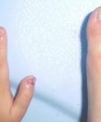 ڲĺ֢޶ָ׺ͽָ䣬Ѿµĳ