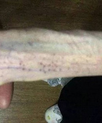 不忍直视!女孩减肥仅剩50斤