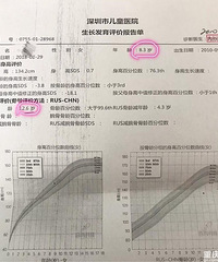 性早熟的危害真不敢想象!8岁女孩骨龄超了4岁,还有半年来月经