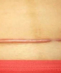 ʸ˿޶һˣѹŵʱ򻹻