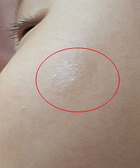 鷳Ұҿ޶ϳʲôòʲôҩ