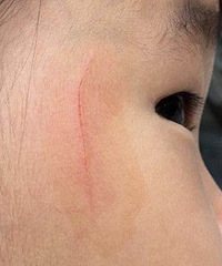 ޶Լͷ̩ϰץˣþôȮЧ