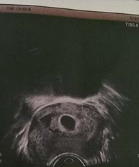 等待14年,终于等来娃