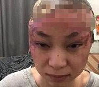 研究生原配被逼自杀ICU抢救