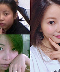 18年逆袭大变脸,谈谈变白变美的经验