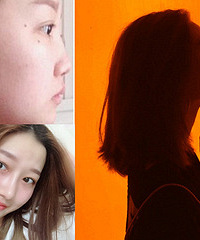 隆鼻了半年,就算不化妆也能美美的