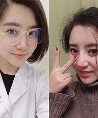 做了近视手术后,眼睛变得清晰又有神