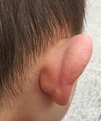 ޶ҧˣѾ˻Ǻ״̬òʲôҩ