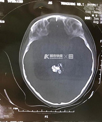 5кﾹȻ9ݣ­ڰﻹͷ