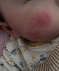 йıֱ˲𣬰ƤõĶͯ˪