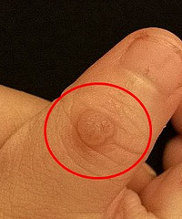 ޶ǳʲôҽ˵Ҫ䶳ƻߴ