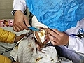 她被多条野狗咬伤