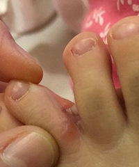 ޶ĽֺƤأ滹Сݣôҩ