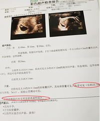怀孕生娃后,我身材没变化