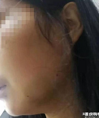 Ϊӱ޹ǣӱڵأָۣദ