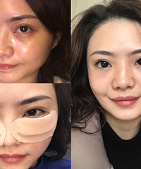 没有大眼袋和黑眼圈,看起年轻多了