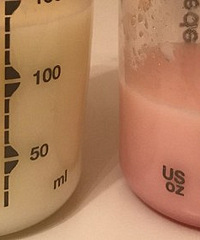 ͻȻѪΣŵȥҽԺΪѪĸ