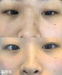 ���¼���3DEEP�����Ƶ���������������Ȧ�����¼�����