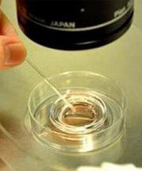 医生科普试管婴儿的流程