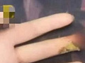 手指被夹,奶奶涂花椒