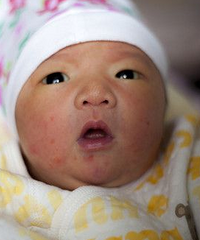 ЩҽԺӤDQ֣ضȻסԺҪÿ¶