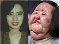 电风扇阿姨整容好可怕