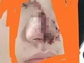 她酒后逗狗被咬伤