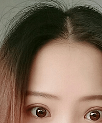 �����޺�˫��Ƥ��һ�����º�Ч�����ǿ���ô��