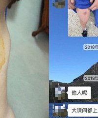 ӺͬѧѧУͻⱩ򣬶ԷҳӴֺ