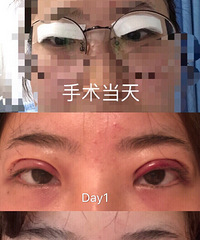 ȫ��˫��Ƥ��¼��+�������ռǡ�