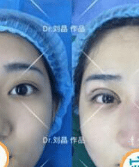 �ɶ���˫��ƤΪʲô�۸�β�룬����ҽ��Ϊ��ҽ���