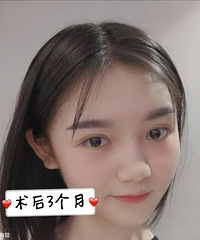 ���졾ȫ��˫��Ƥ+���۽ǡ����������+�������ռǡ�