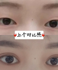 ���졾ȫ��˫��Ƥ+���۽ǡ����������+�������ռǡ�