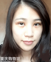 ����С��˫+���ԳƵ��۾������ڵ���״������+�������ռǡ�