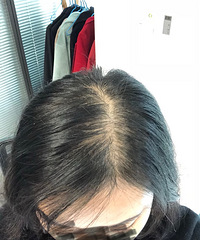 脱发少女终于有救了,用了这个护发单品,我头发长出来了好多
