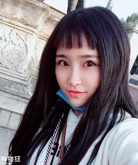 M唇术后100天效果满意100分+【变美日记】