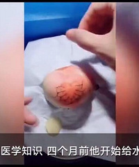 Ϊ��2������˽�ҽѧ��ʶ��32��ҽ���ְָ�ˮ��������