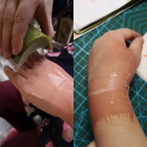 被开水烫伤用这个有效