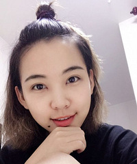 做了双眼皮后改变好大,整个人都灵气了很多