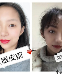 ˫��Ƥ���ԡ�������˫��Ƥ����