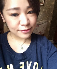 亲身经历附图,这2千块钱的眼袋手术太值了!