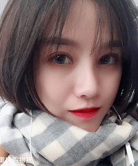 做了一个超成功的双眼皮,恢复三个月素颜也很自然