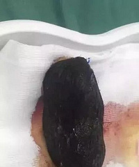 㽭ŮȡͷⶼԴдҵһ