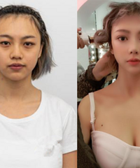 û�뵽��˫��Ƥ��¡���ָܻ���ô�죡15���������д����