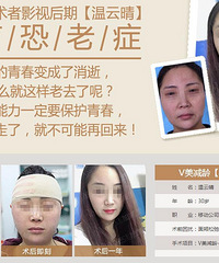 V美减龄 有哪些面部除皱的方法 穆宝安